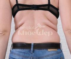 Hút Mỡ Lưng An Toàn & Hiệu Quả – Đấu Giá Dịch Vụ Giá Tốt tại thegioikhoedep.com