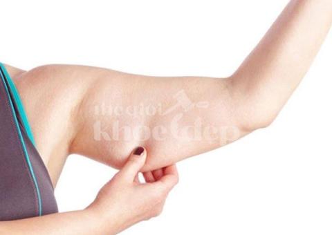 Đấu Giá Hút Mỡ Bắp Tay – Giảm Béo Nhanh & An Toàn | TheGioiKhoeDep.com