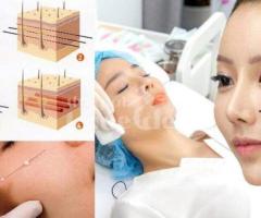 Căng chỉ nâng cơ – Giải pháp trẻ hóa da hiệu quả, an toàn, không phẫu thuật