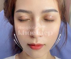 Căng chỉ nâng cơ sau giảm cân – Khắc phục da chảy xệ hiệu quả