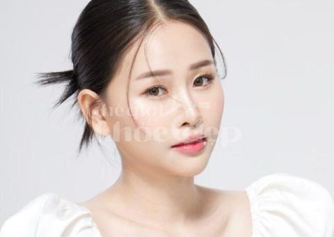 Căng chỉ nâng cơ sau 35 tuổi – Giải pháp trẻ hóa, níu giữ thanh xuân - 3/4