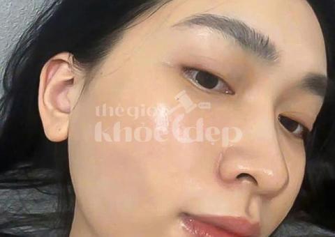 “Tạm Biệt Mụn Đầu Đen – Da Sáng Láng, Không Lỗ Chân Lông To!” - 3/3