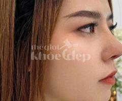 Nâng mũi bán cấu trúc 2025 – Dáng mũi đẹp tự nhiên, an toàn chuẩn y khoa