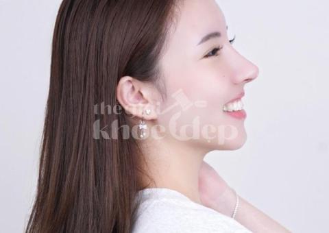 Nâng mũi cấu trúc toàn phần 2025 – Dáng mũi cao thanh tú, chuẩn y khoa - 1/3