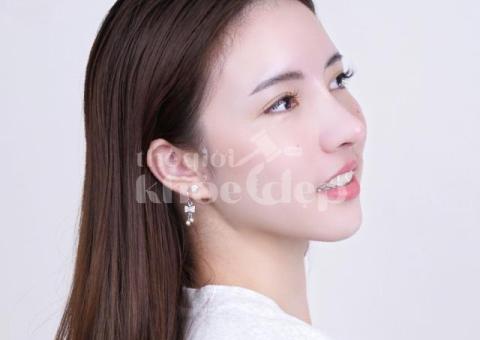 Nâng mũi cấu trúc toàn phần 2025 – Dáng mũi cao thanh tú, chuẩn y khoa - 2/3