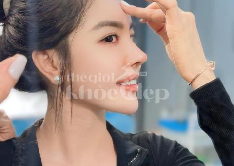 Nâng mũi Revision 2025 – Khắc phục mũi hỏng, sửa biến chứng an toàn