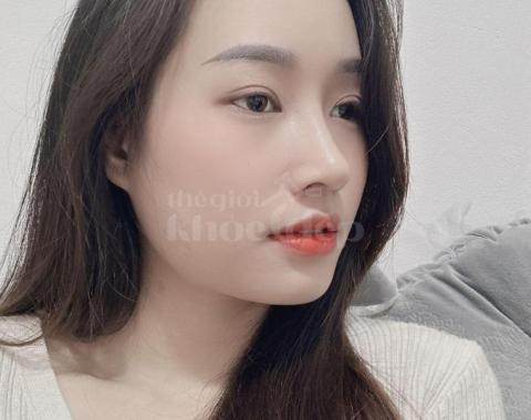 Nâng mũi chuẩn y khoa – dáng đẹp tự nhiên, an toàn tuyệt đối - 2/2