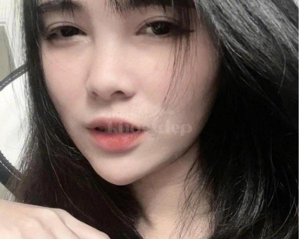 Nâng mũi cấu trúc – Giải pháp cho mũi thấp, đầu mũi to, biến chứng tối thiểu - 1/3