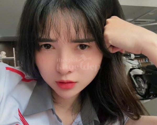 Nâng mũi cấu trúc – Giải pháp cho mũi thấp, đầu mũi to, biến chứng tối thiểu - 2/3