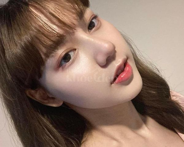 Nâng mũi S-line – Dáng mũi tự nhiên, thon gọn, thanh thoát gương mặt - 2/4