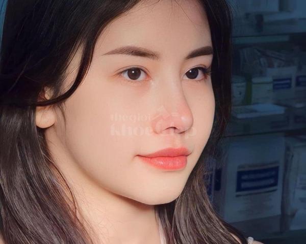 Nâng mũi S-line Ultimate – Sống mũi cao, đầu mũi thanh thoát, gương mặt hài hòa - 2/5