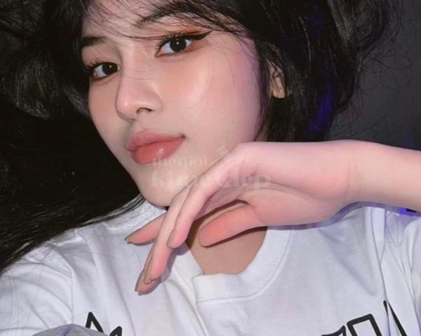 Nâng mũi 4D cấu trúc chuẩn y khoa – Dáng mũi cao tự nhiên, đẹp bền lâu - 5/7