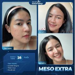 Meso Extra Không Kim: Trẻ Hóa Da, Xóa Nhăn Không Xâm Lấn 2025