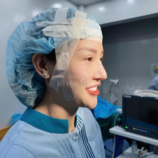 Nâng mũi cấu trúc 4D tự nhiên, an toàn – Giải pháp hoàn hảo cho dáng mũi đẹp lâu dài - 5/6