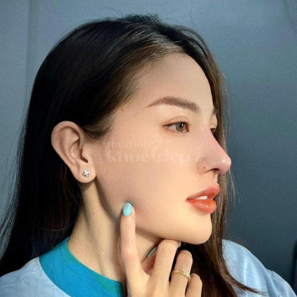 Nâng mũi cấu trúc 4D tự nhiên, an toàn – Giải pháp hoàn hảo cho dáng mũi đẹp lâu dài - 6/6