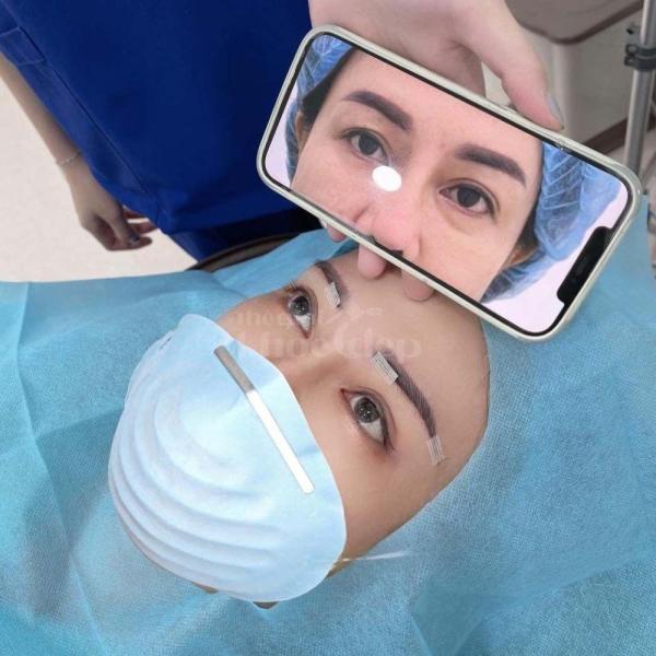 Cắt mí – Nhấn mí Mini Deep: Đôi mắt 2 mí đẹp tự nhiên, trẻ trung - 1/4